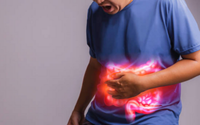Irritable Bowel Syndrome (IBS) - Vipulroy Rathod Irritable Bowel Syndrome