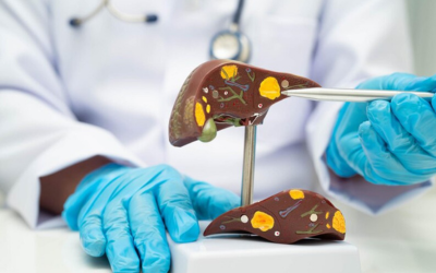 Hepato-Pancreato-Biliary HPB Endoscopy - Vipulroy Rathod