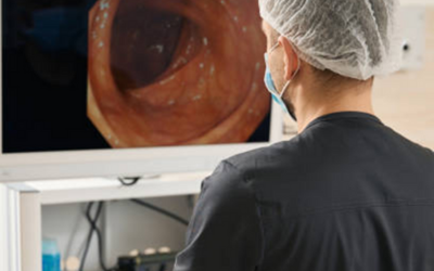 Endoscopic Ultrasound EUS - Vipulroy Rathod