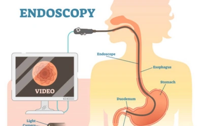 Endoscopic Procedures - Vipulroy Rathod