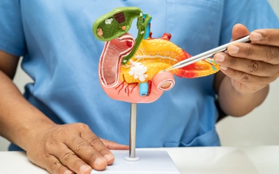 Pancreatic Cancer - Vipulroy Rathod