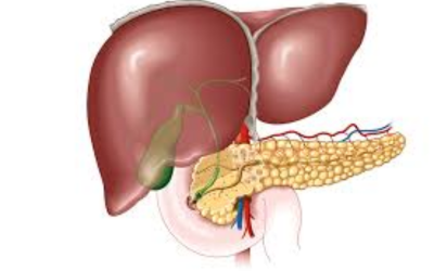 Bile duct obstruction