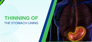 Thinning of the Stomach Lining: Causes, Symptoms, and Treatment