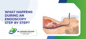 What Happens During an Endoscopy Step by Step?