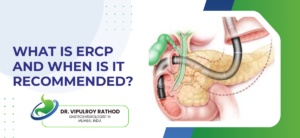 What Is ERCP and When Is It Recommended?