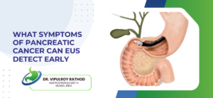 What Symptoms of Pancreatic Cancer Can EUS Detect Early