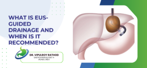 What Is EUS-Guided Drainage and When Is It Recommended