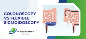 Colonoscopy vs Flexible Sigmoidoscopy