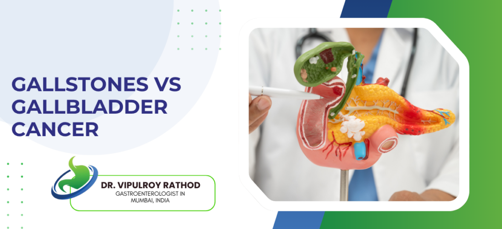 Slide title 'Gallstones vs Gallbladder Cancer' with a doctor presenting a 3D gallbladder model on the right.