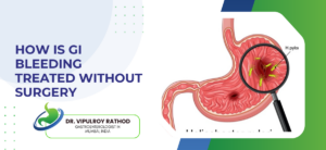 How Is GI Bleeding Treated Without Surgery
