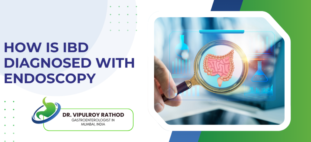 Banner for an article on diagnosing IBD with endoscopy, showing a magnified colon image on a digital screen