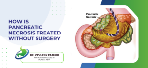 How Is Pancreatic Necrosis Treated Without Surgery