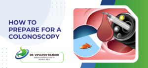 How to Prepare for a Colonoscopy