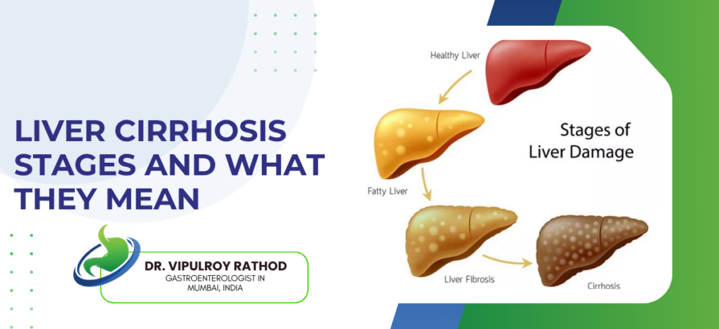 Banner about liver cirrhosis stages showing a diagram of healthy, fatty, fibrotic, and cirrhotic liver; includes the text 'LIVER CIRRHOSIS STAGES AND WHAT THEY MEAN' and a doctor’s logo/name.