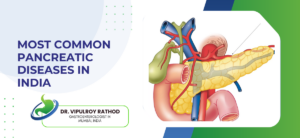 Most Common Pancreatic Diseases in India