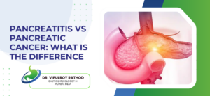 Pancreatitis vs Pancreatic Cancer: What Is the Difference