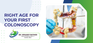 Right Age for Your First Colonoscopy