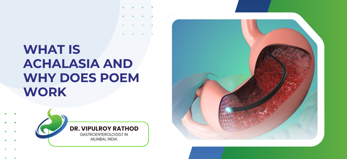 What Is Achalasia And Why Does POEM Work