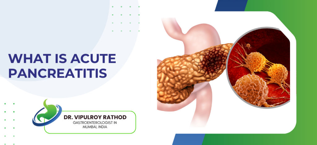 Educational banner about acute pancreatitis showing a 3D pancreas illustration, a magnified cancer-cell image, and the Dr. Vipul Roy Rathod logo.