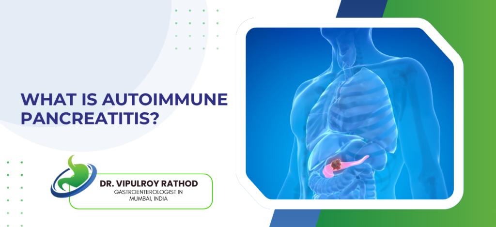 What Is Autoimmune Pancreatitis
