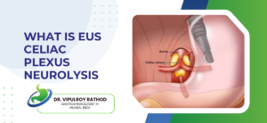 What Is EUS Celiac Plexus Neurolysis