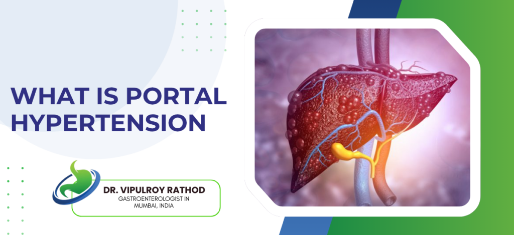 Banner slide titled 'What Is Portal Hypertension' with a detailed liver illustration on the right and a logo for Dr. Vipul Roy Rathod at the bottom left.