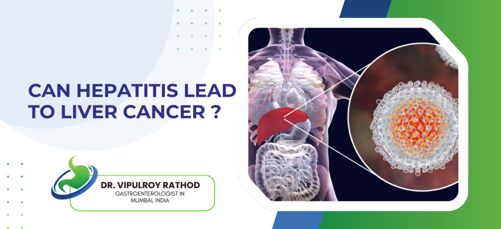 Banner announcing 'Can Hepatitis Lead to Liver Cancer?' with a medical illustration showing a human torso highlighting the liver and a magnified cancer cell, plus the doctor’s logo.