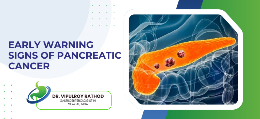 Banner image announcing early warning signs of pancreatic cancer with a pancreas illustration on the right and a doctor’s name and logo on the left.