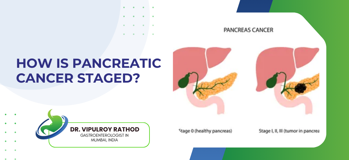 Slide titled 'HOW IS PANCREATIC CANCER STAGED?' with two pancreatic diagrams (Stage 0 vs Stage I-III) and a medical logo at the bottom left.