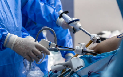 Surgeons in blue sterile gowns perform laparoscopic surgery, guiding instruments through small ports on a patient’s abdomen.