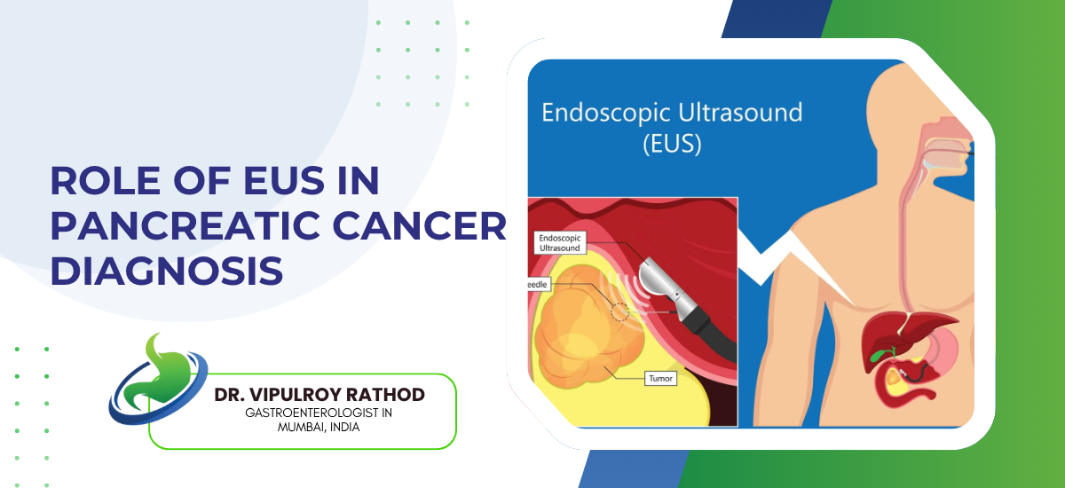 Slide titled 'Role of EUS in Pancreatic Cancer Diagnosis' with an EUS diagram and a physician logo at the bottom left.