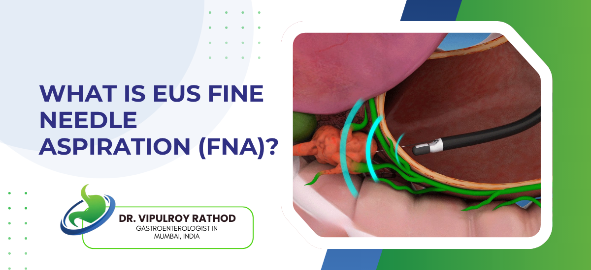 What Is EUS Fine Needle Aspiration? | Dr. Vipulroy Rathod