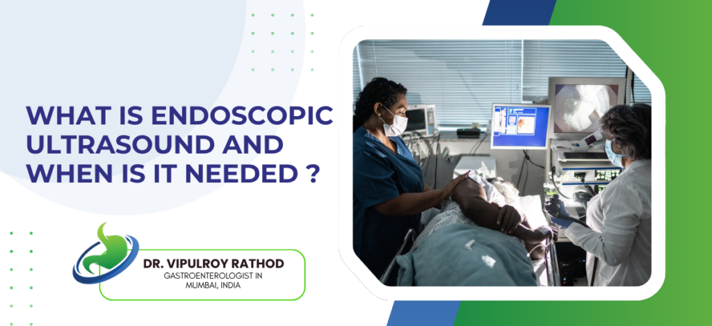 What is endoscopic ultrasound and when is it needed | dr. Vipulroy rathod | dr. Vipulroy rathod Header banner: doctors perform an endoscopic ultrasound on a patient with monitors and equipment nearby.