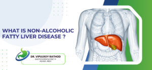 What Is Non-Alcoholic Fatty Liver Disease?