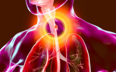Medical illustration of the human neck and chest showing the larynx and upper airway highlighted in bright orange to indicate the airway focus.