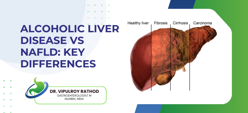 Alcoholic Liver Disease vs NAFLD