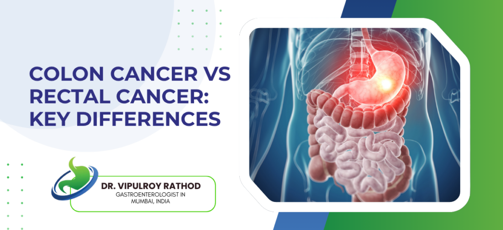 Colon Cancer vs Rectal Cancer