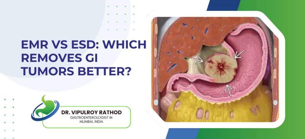 EMR vs ESD