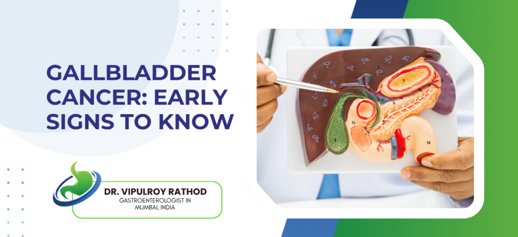 Gallbladder Cancer Early Signs