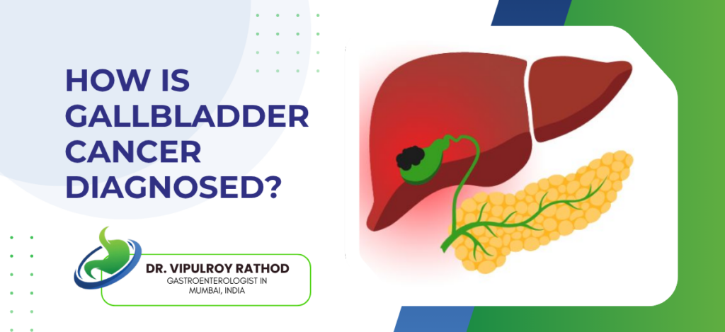 Gallbladder Cancer Diagnosed