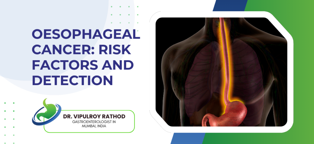 Oesophageal Cancer Risk Factors
