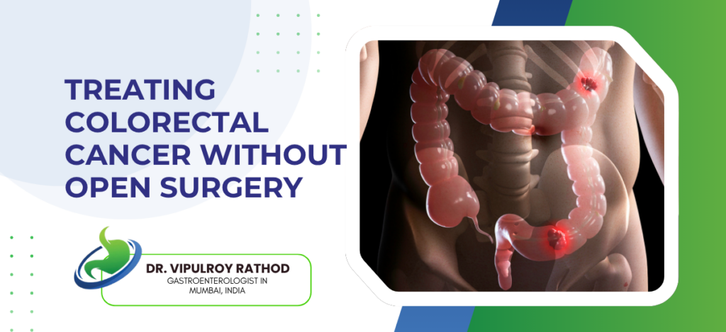 Colorectal Cancer Without Open Surgery