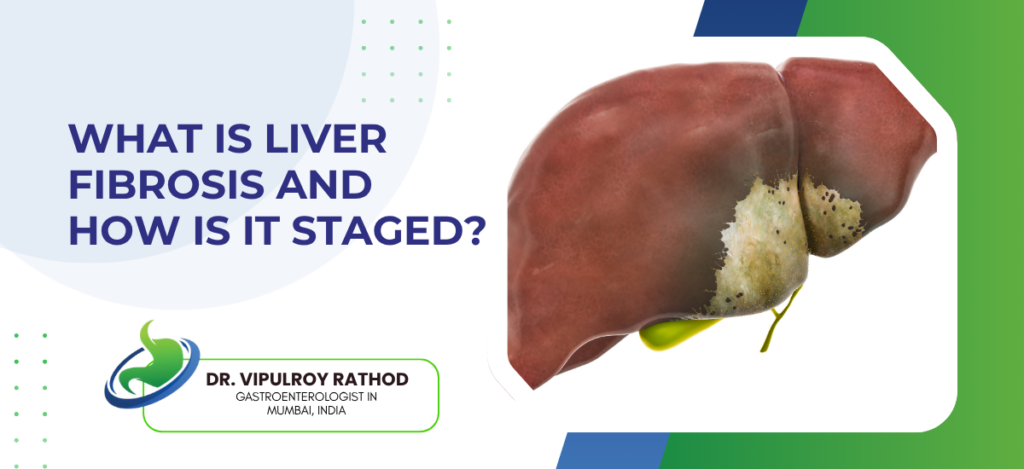 Liver Fibrosis and How Is It Staged