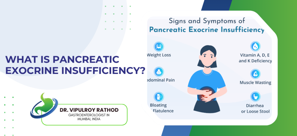 What is pancreatic exocrine insufficiency | dr. Vipulroy rathod | dr. Vipulroy rathod Infographic about signs and symptoms of pancreatic exocrine insufficiency, showing a person holding their stomach and a bullet list of symptoms: weight loss, abdominal pain, bloating, vitamin deficiencies, muscle wasting, diarrhea.