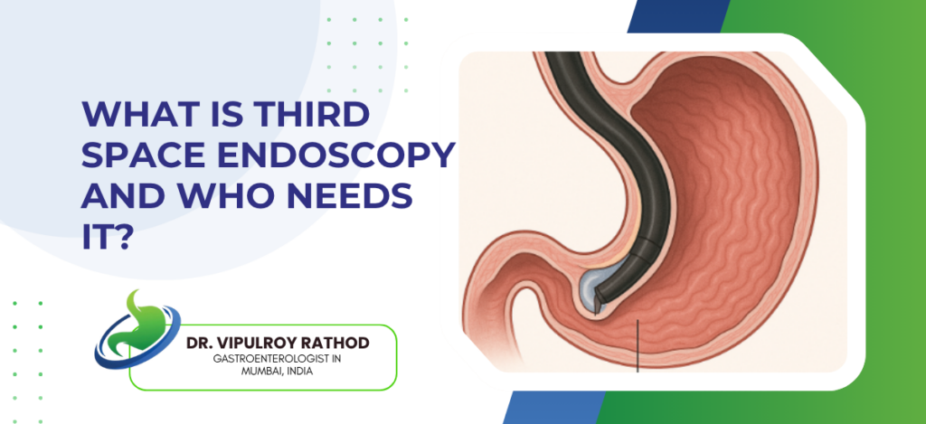 Third Space Endoscopy