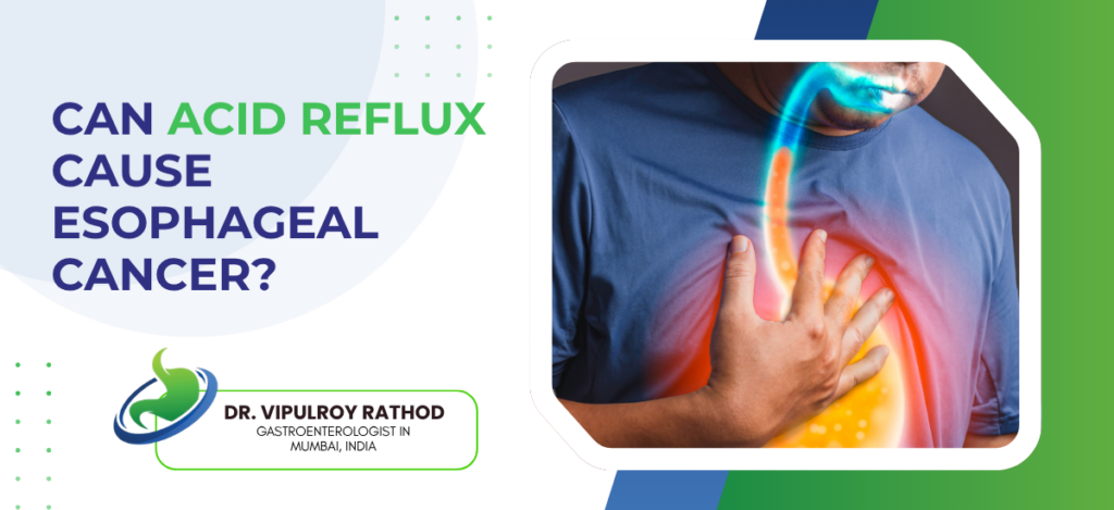 Informational banner asking if acid reflux can cause esophageal cancer, featuring a chest image and doctor Dr. Vipulroy Rathod's logo and title.