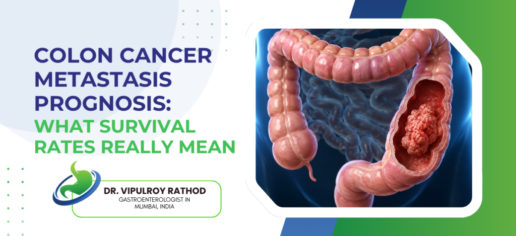Educational banner on colon cancer prognosis with bold blue/green title and a 3D colon illustration on the right, plus a doctor’s logo area.