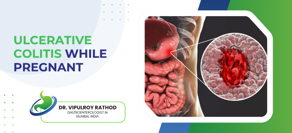 Banner for an article: 'Ulcerative Colitis While Pregnant' with a detailed gut diagram and a magnified inflamed tissue view, plus the doctor’s logo and name.