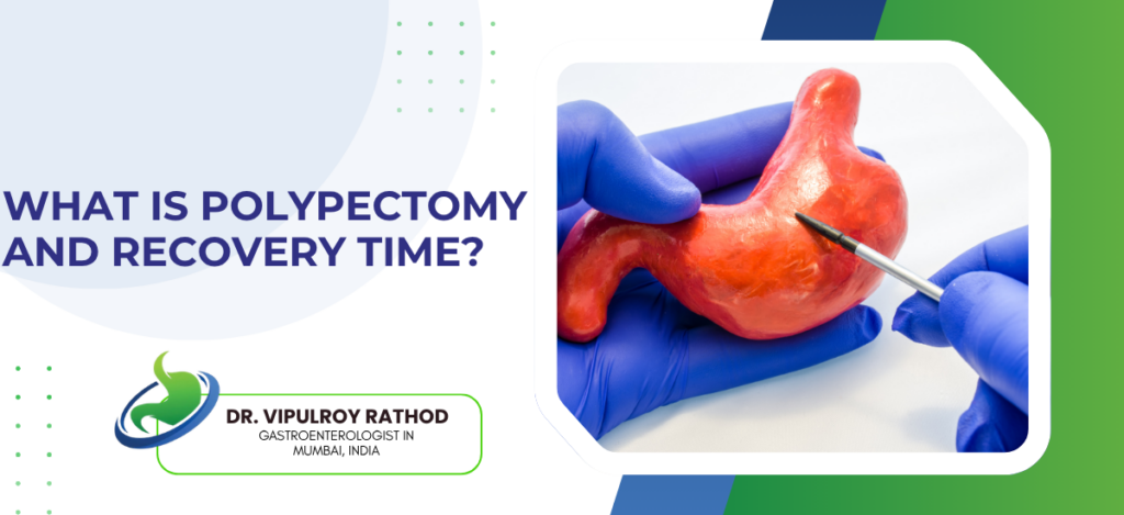 Educational slide on polypectomy and recovery time, with a close-up of blue-gloved hands using a scalpel on an orange polyp and a doctor’s logo at the bottom left.