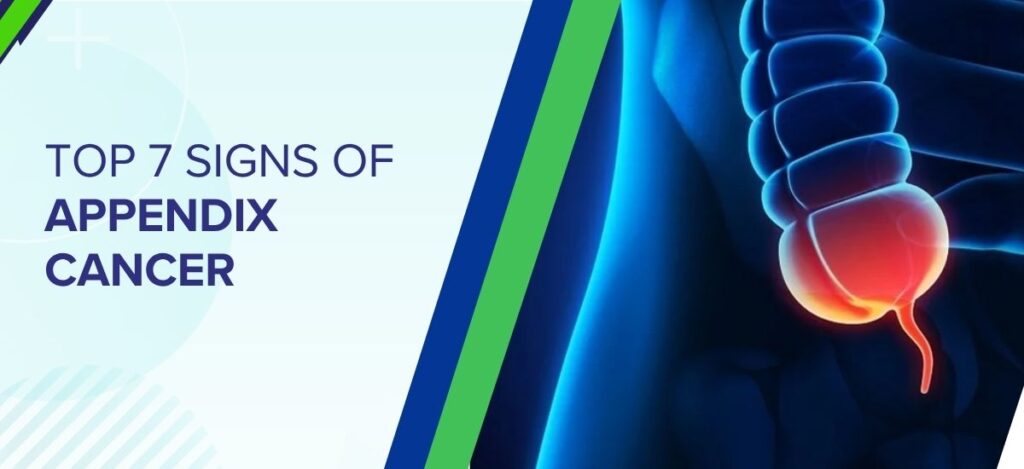 Banner reading 'Top 7 Signs of Appendix Cancer' with a blue illustrated intestine on the right side and geometric shapes on a pale background.